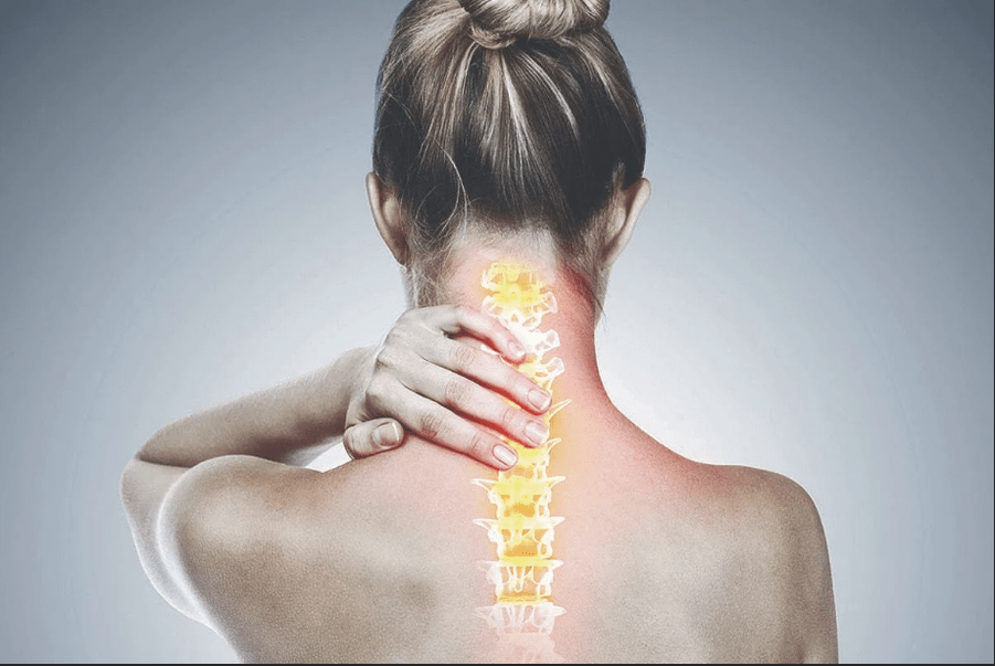 cervical osteochondrosis