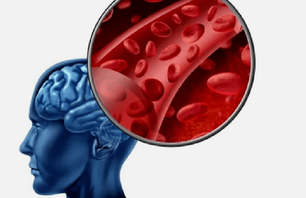 Symptoms of osteochondrosis of the cervical spine