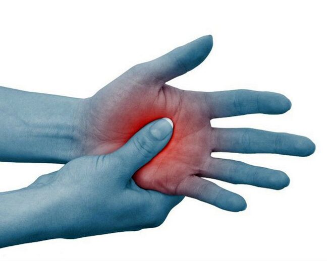 Severe pain in the joints of the fingers, decreasing with exercise, is a typical sign of rheumatoid arthritis. 